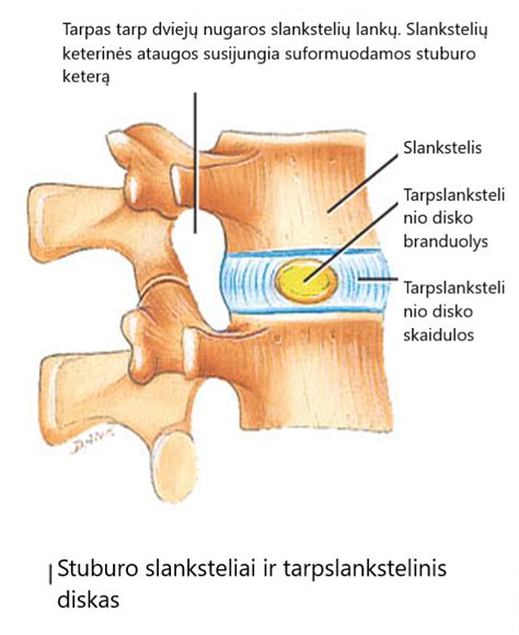 Stuburo slankstelio kompresijos schema