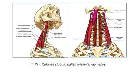 Stuburo stabilizacijos žemėlapis: gilieji vs paviršiniai raumenys