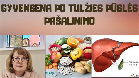 Infografika, paaiškinanti virškinimo procesą ir tulžies vaidmenį