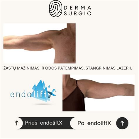 nuotrauka, demonstruojanti skirtingų tipų odos tekstūras ir siūlių pavyzdžius