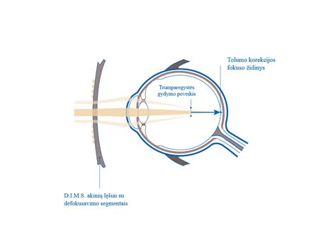 Schema: Fotochrominių lęšių veikimo principas