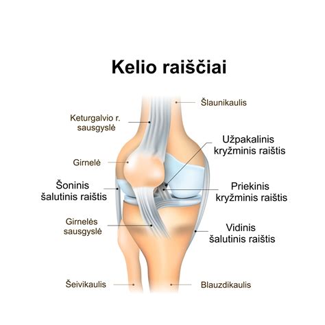 schema: priekinio žibinto komponentų išsidėstymas ir prieigos taškai