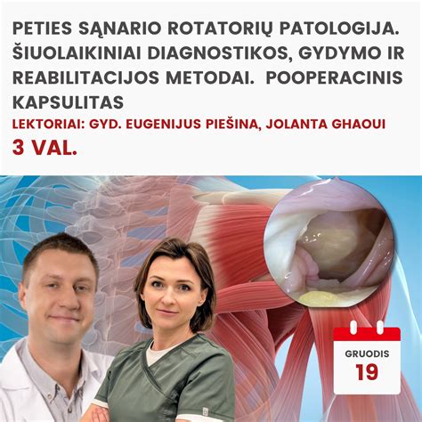 Peties sąnario diagnostikos metodų infografika