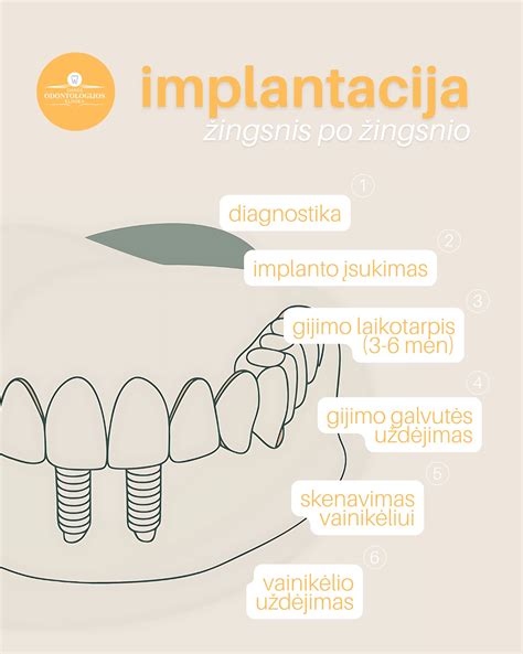 Infografika: kaulo gijimo procesas po lūžio
