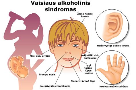 schematinė iliustracija, vaizduojanti skirtingas alkoholio promilių vertes ir su jomis susijusias sankcijas (teisės atėmimo trukmė, baudos dydis)
