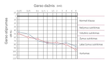 Vairuotojo klausos tyrimo audiograma