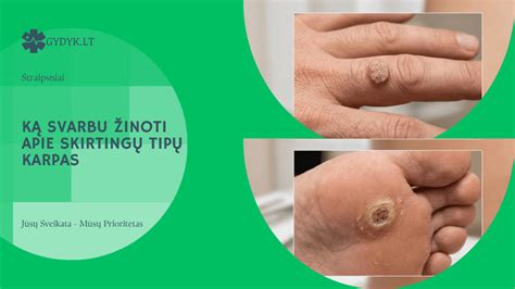 Infografika apie skirtingų poliruoklių tipų ypatybes ir rekomendacijas